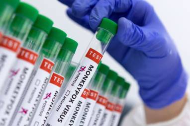 Ministério da Saúde confirma 8º caso de varíola dos macacos no país | VEJA  SÃO PAULO