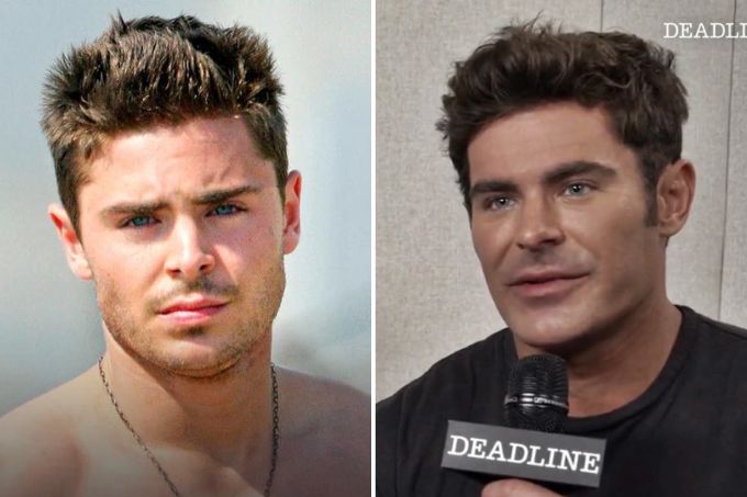 Rosto de Zac Efron volta a receber críticas; ator diz que sofreu acidente
