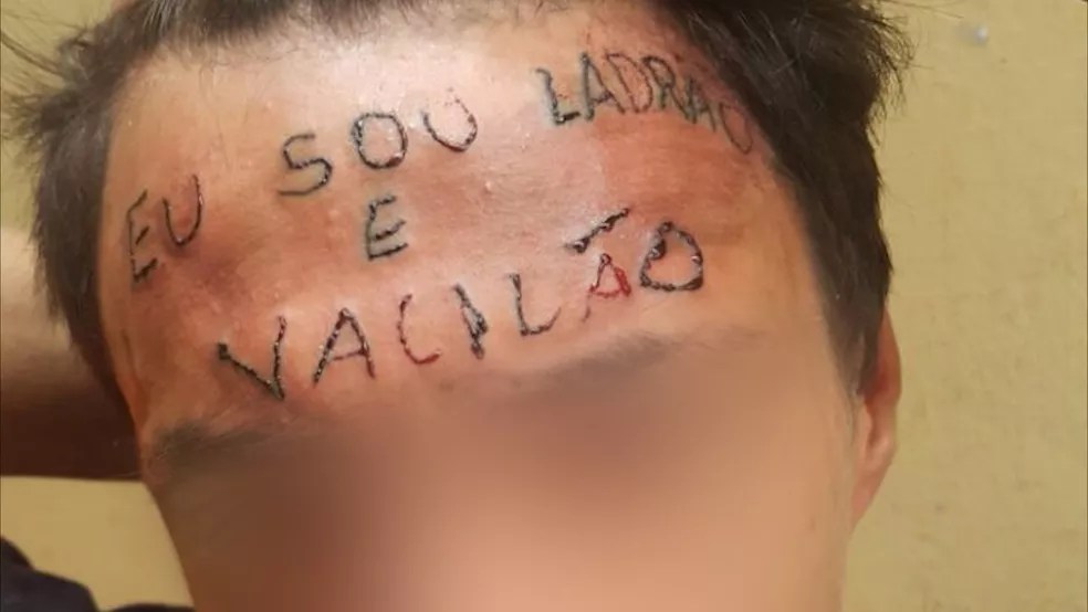 "Eu sou ladrão e vacição" foi tatuada na testa de jovem