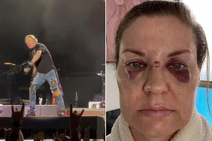 Rebecca Howe diz ter sido ferida por microfone arremessado por Axl Rose em show na Austrália.