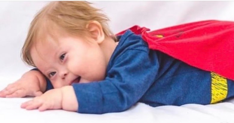 Foto de menino com Síndrome de Down deitado de barriga para baixo, com roupa de super-homem, sorrindo