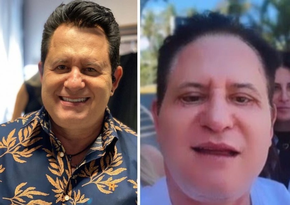 Marrone relata melhora na vida sexual após procedimentos estéticos