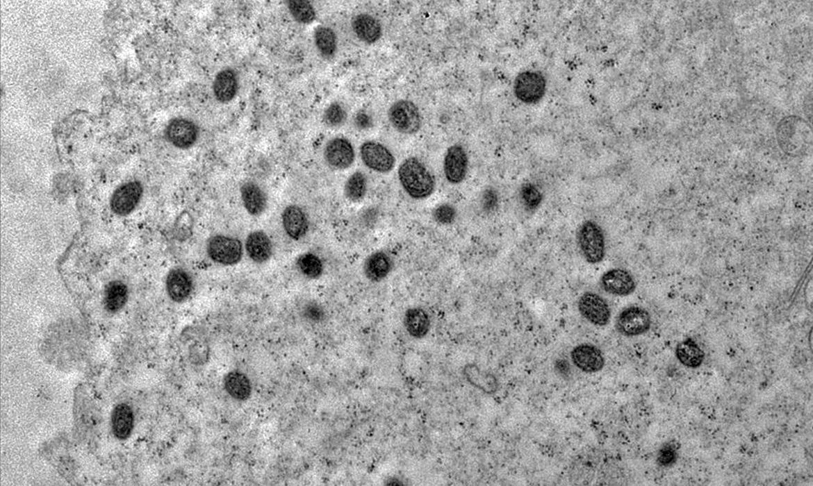 Imagem microscópica mostra vírus de mokeypox