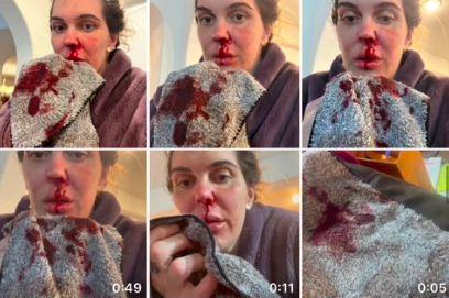 Campeã de jiu-jítsu denuncia ex-marido por violência doméstica