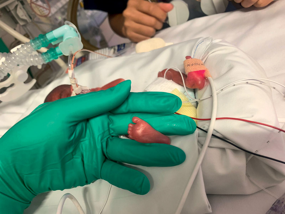 Menor bebê nascido no SUS se adapta à vida em casa