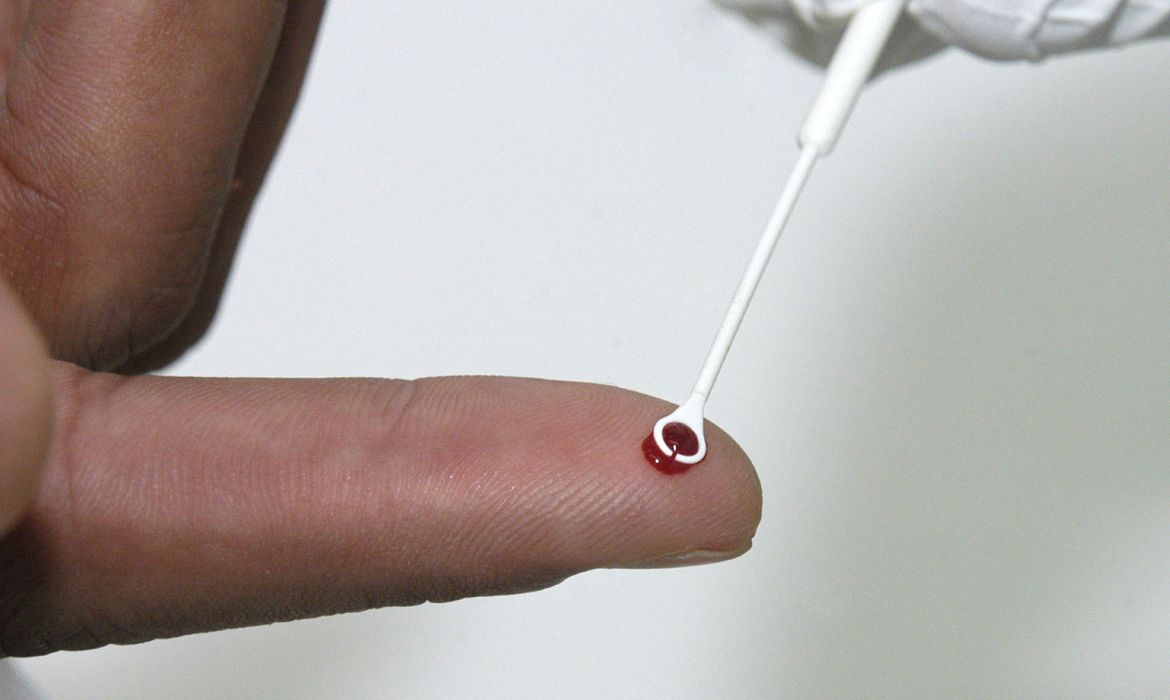 Realização de teste rápido de HIV, desenvolvido pelo Instituto de Tecnologia em Imunobiológicos (Bio-manguinhos).
