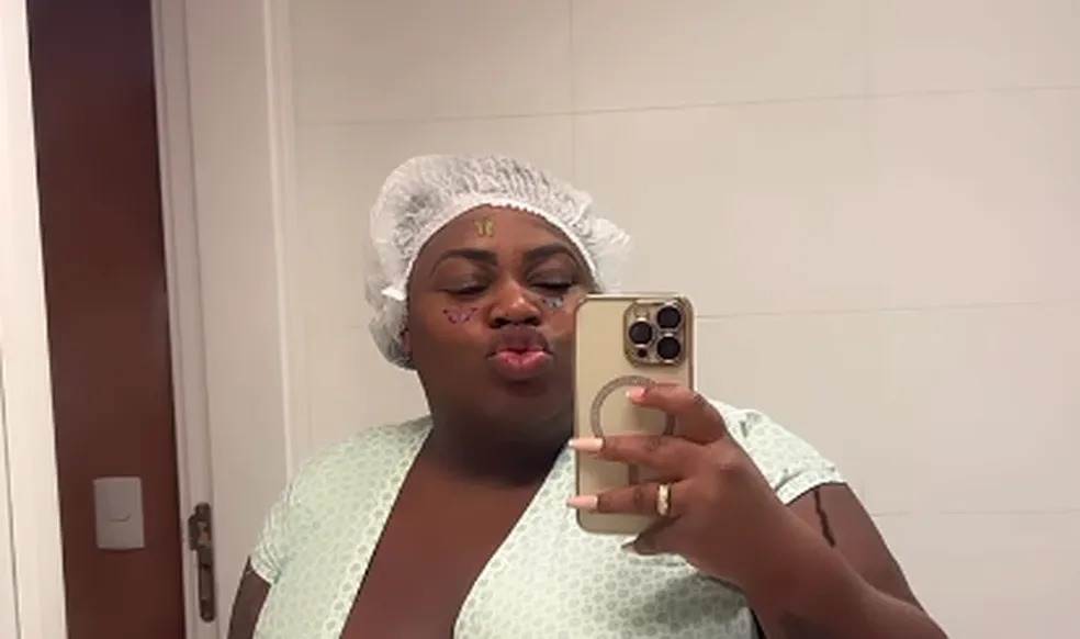 Jojo Todynho faz cirurgia bariátrica e tranquiliza fãs: “Mamãe já volta”