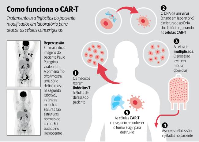 Car-T