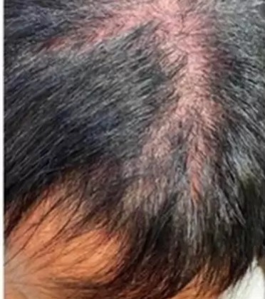 WhatsApp Image 2023-11-10 at 20.31.34 gretchen-cabelo-alopecia