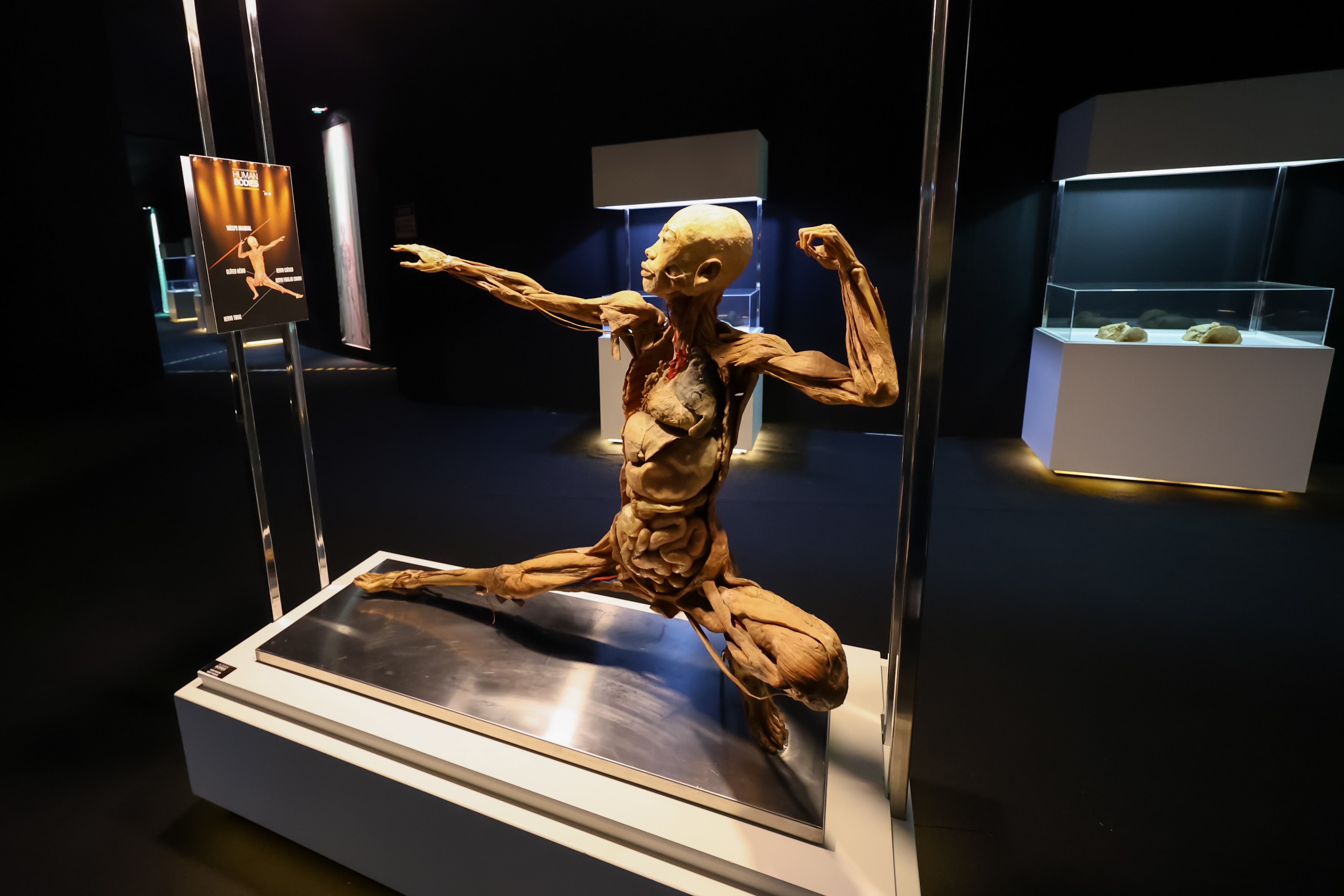 Exposição com 100 órgãos e corpos humanos reais inaugura em São Paulo